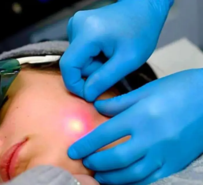 Endolift Boyun Uygulaması Nedir? Boynu Sıkılaştırır mı?