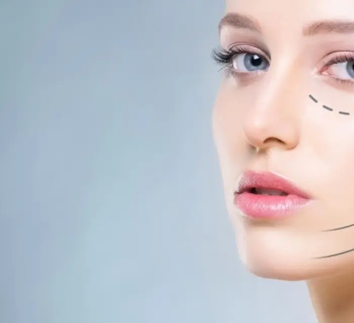 Endolift ile Cilt Sıkılaştırma Nasıl Yapılır? Etkileri